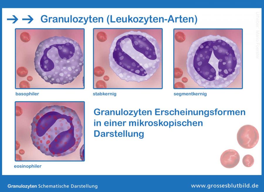 Granulozyten-Leukozyten-Arten