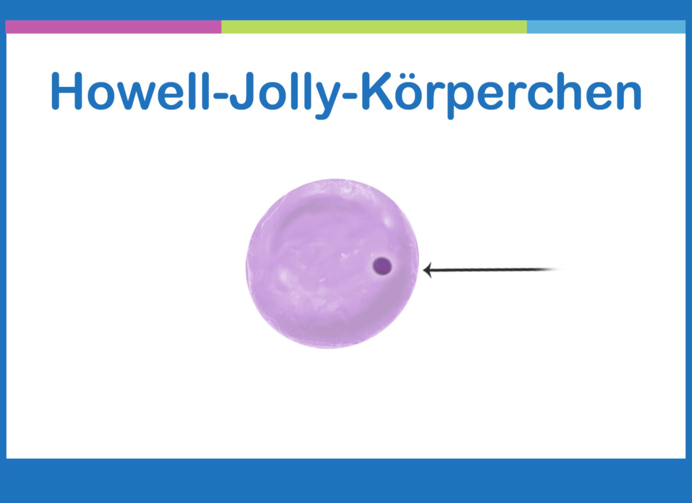 Howell-Jolly-Körperchen