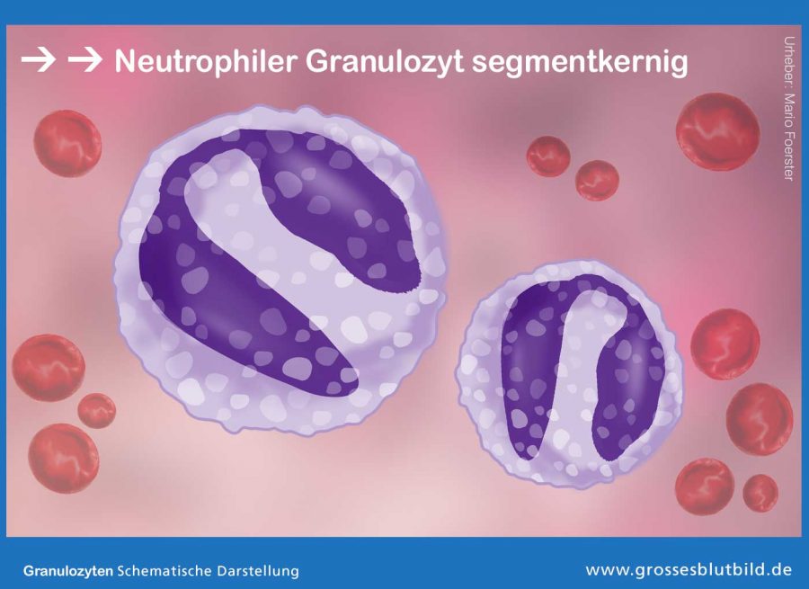 Neutrophiler-Granulozyt-segmentkernig