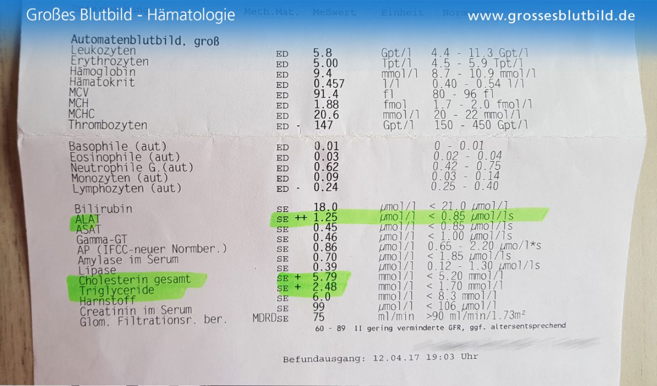 Blutbild Definition und Erklärung » Fotokunstweb.de